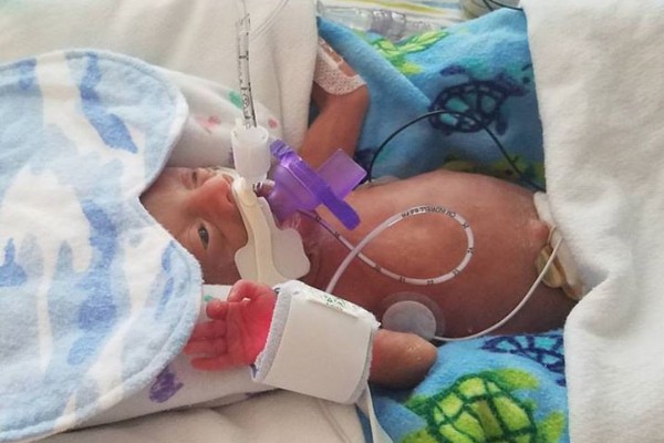 Fundraiser by Mary Sweeney : 24 weeker Liam Parker Shaw