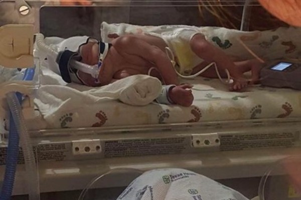 fundraiser for chasity bailey by kathy cox bailey please help baby chasity bailey