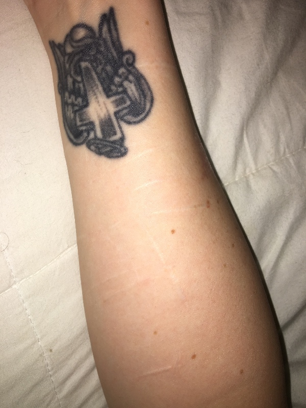 fundraiser by kayla mayeux covering self harm scars w tattoo fundraiser by kayla mayeux covering self harm scars w tattoo