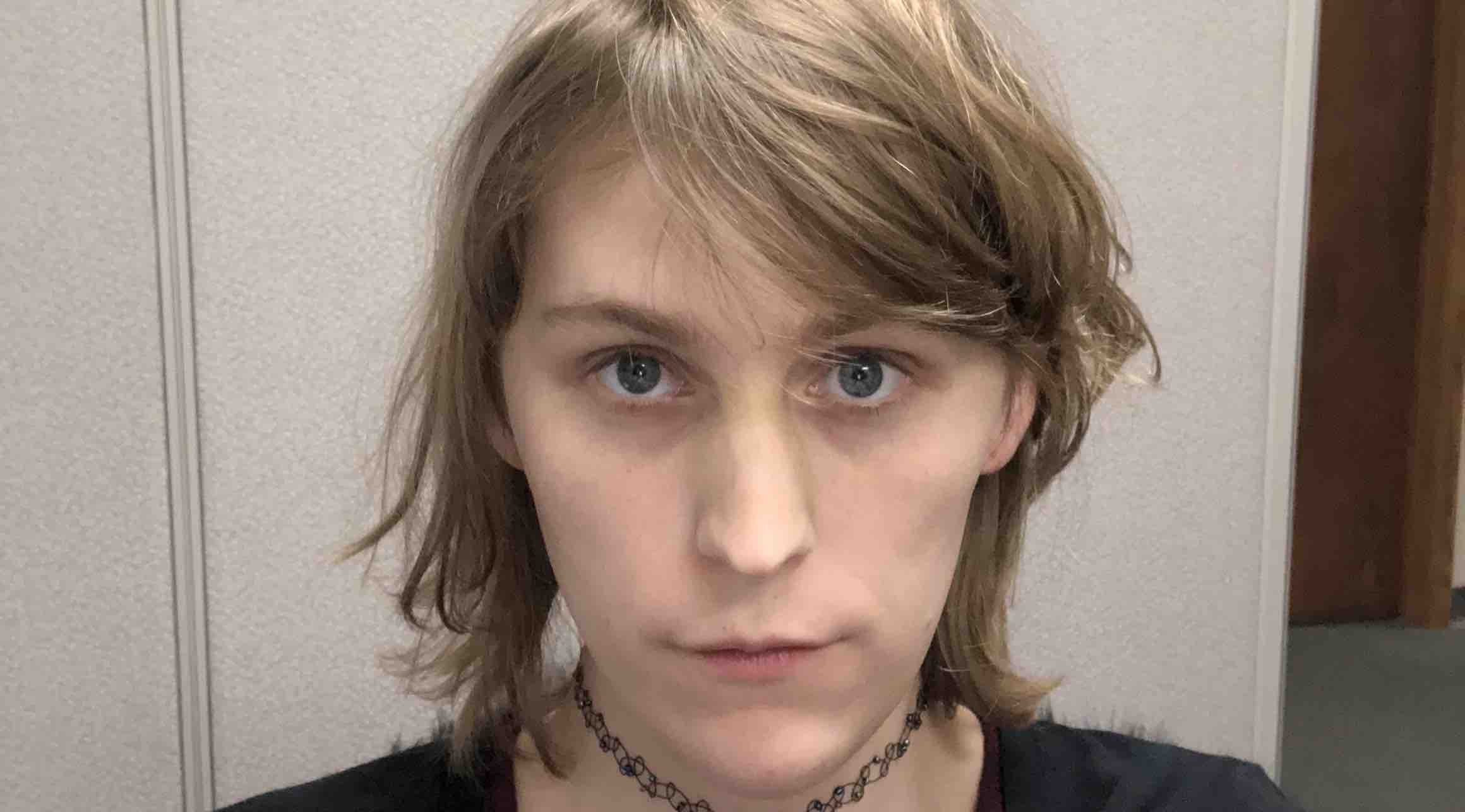 Boy receives facial feminization pics 372