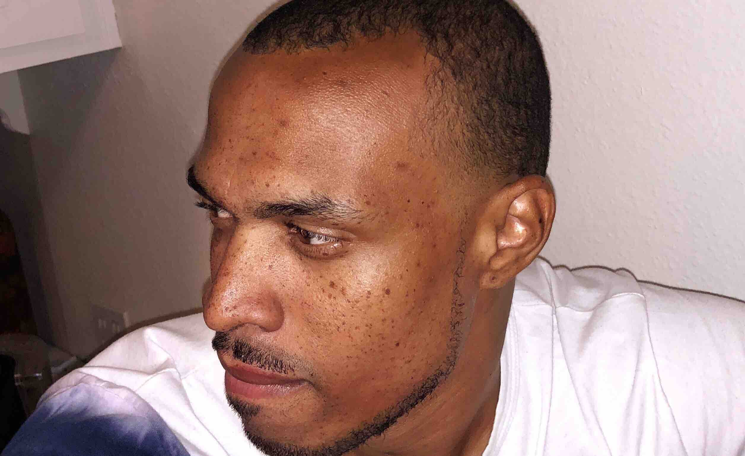 Fundraiser by Ray Hayes Lung Cancer NUT midline carcinoma S3