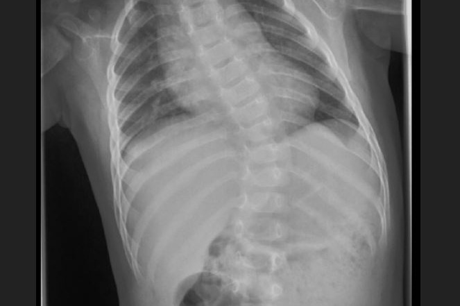 Liam specialized medical help photo