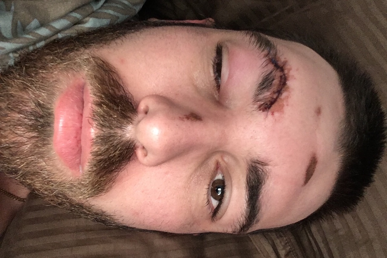 30318562_15279219630_r.jpeg