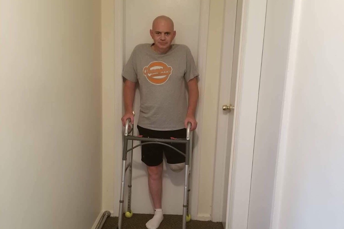 Rob Legs Fundraiser for Robert Cadugan by Tracy Cadugan Flanagan : Prosthetic ...