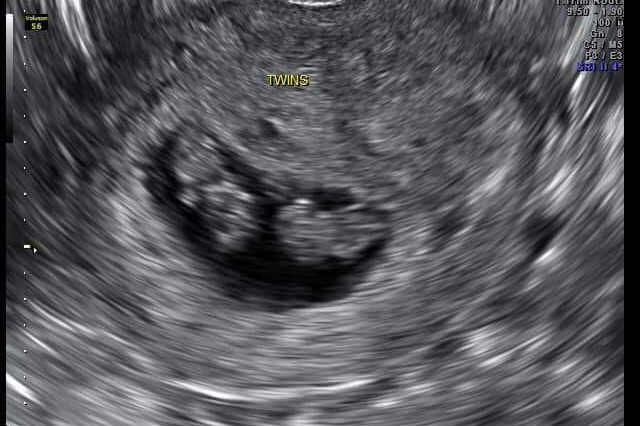 In Memory of Tiffany McDermott and Twins photo