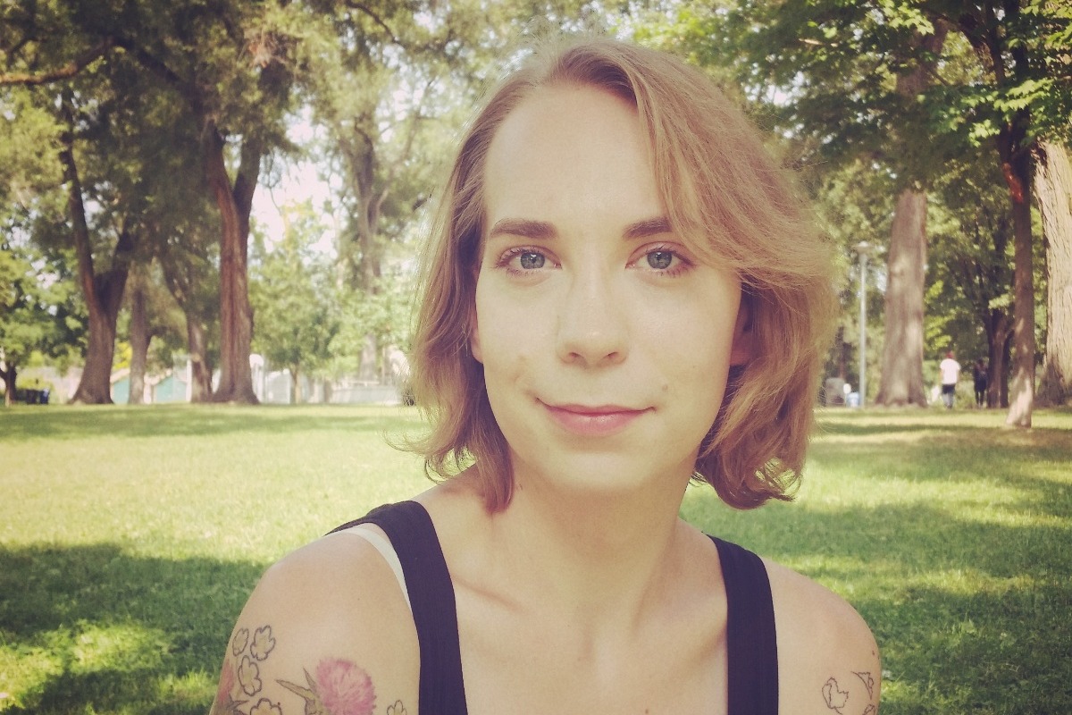 Gwen's Facial Feminization Surgery photo