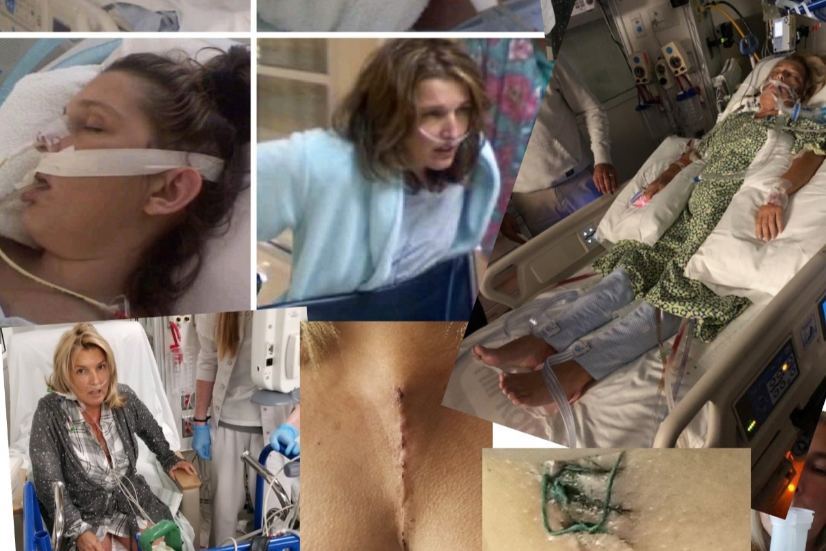 Sherry's 2nd Open Heart Surgery photo
