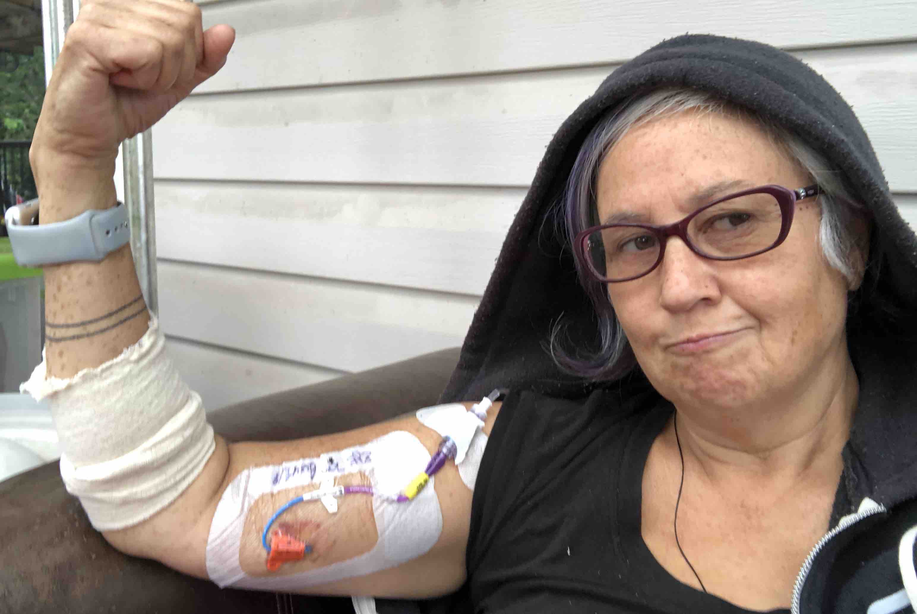 Cease Wyss:Healing From A Broken Leg + 2 Surgeries photo