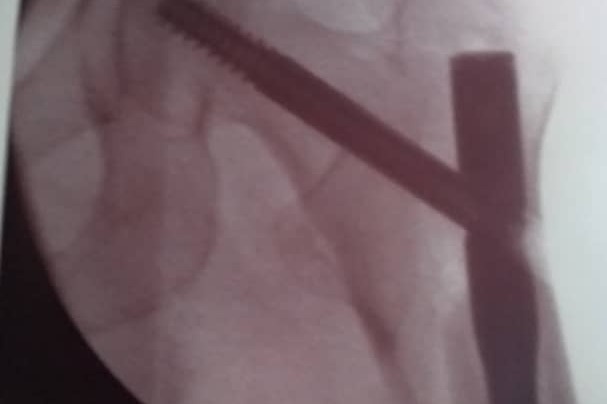 41054648_1564758203617612_r.jpeg