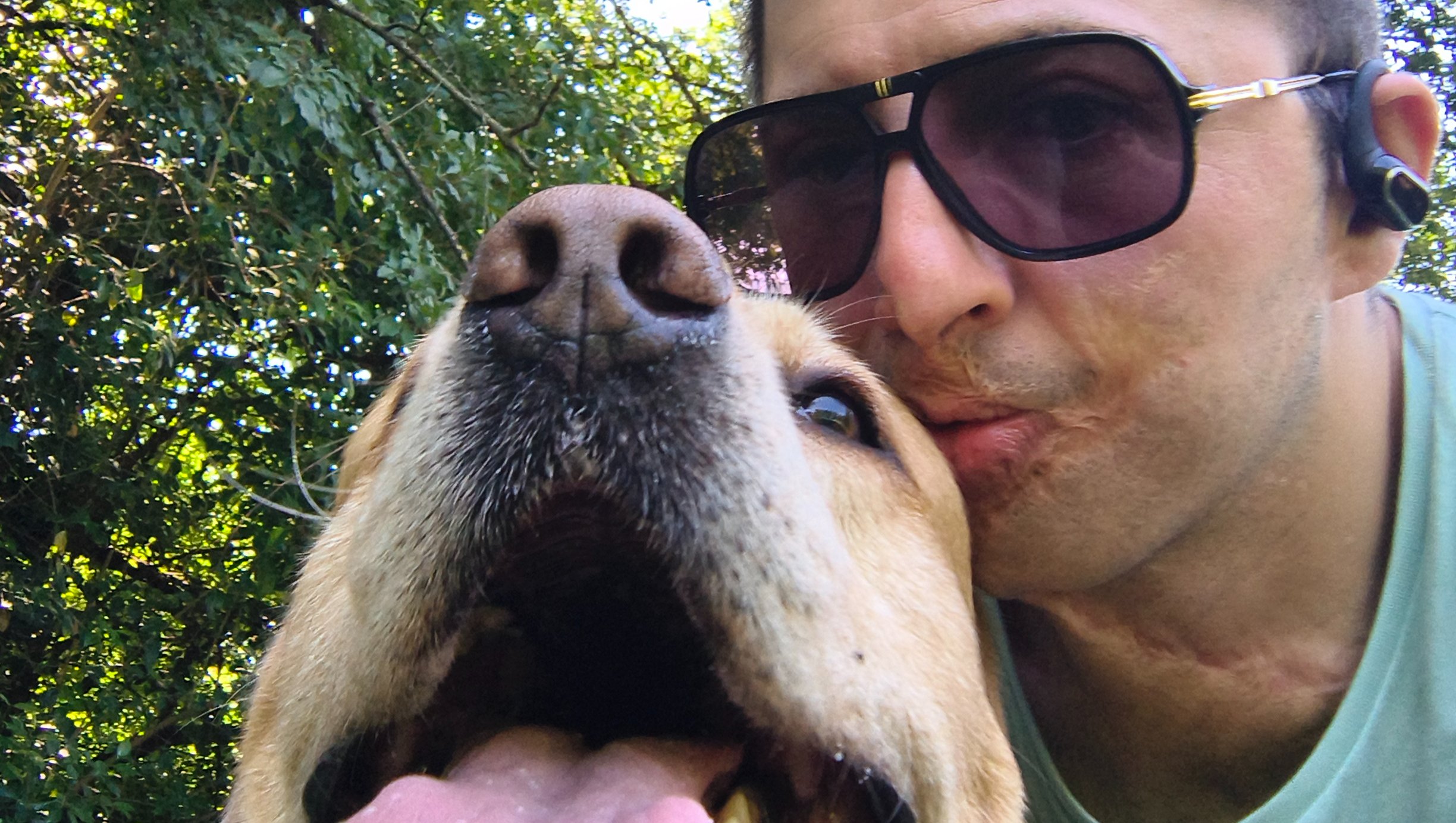 Aiutiamo Giuseppe, sfregiato con l'acido photo