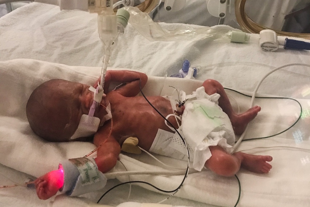 Supporting Baby Mia Rostoni photo