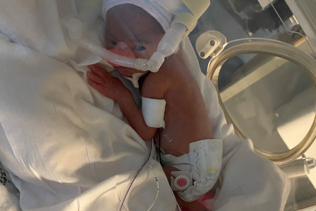 11 week premature baby