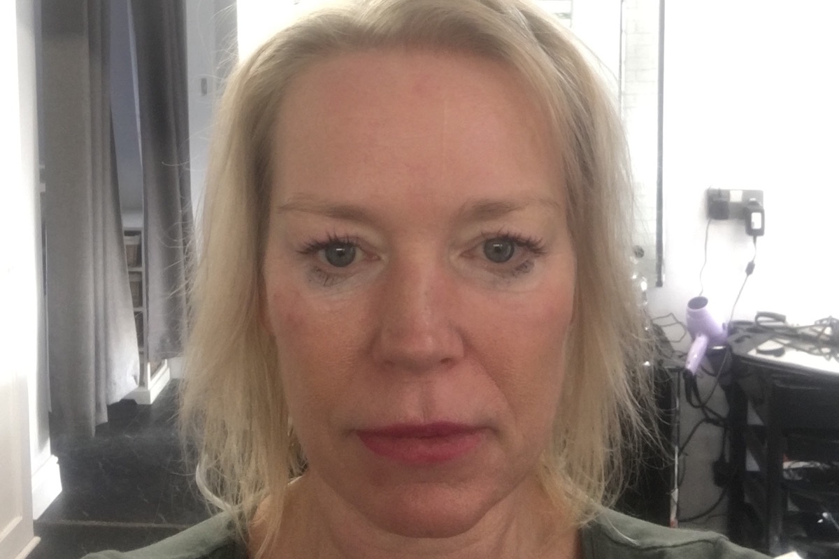 Fundraiser By Joanna Leverett Hair Loss For Men And Women