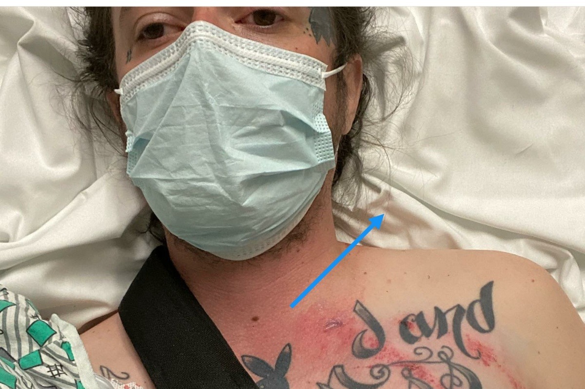 Help Tims hospital bills photo