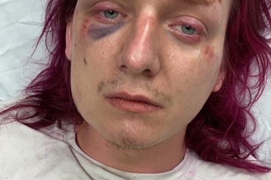 Hate crime recovery fund photo