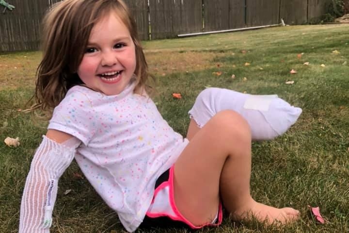 Mom Says 3-Year-Old Daughter Is Doing “Far Better Than All the Adults in Her Life' After Lawnmower Accident Takes Her Leg