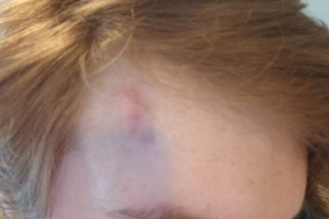 Altadenans Helping Damien photo