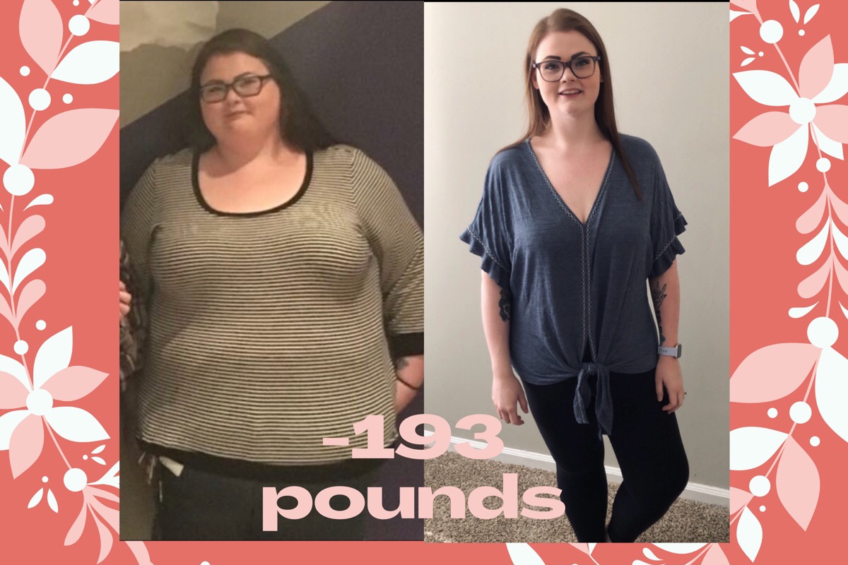 Fundraiser By Savanna Thompson Loose Skin Removal Surgery