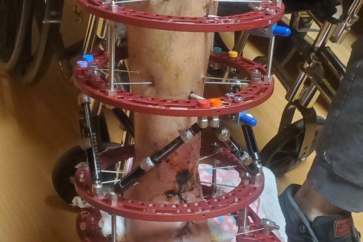 52694160_160579111451158_r.jpeg