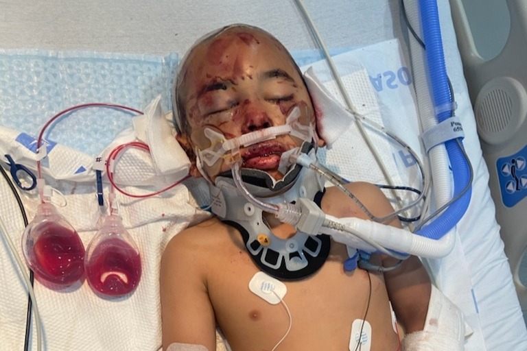 Mason fighting for his life in the pediatric ICU photo