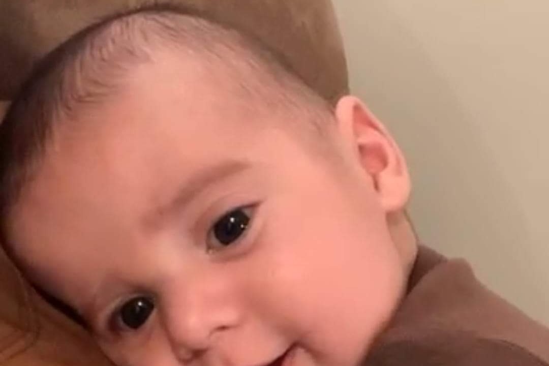 Help Greyson with costs for his surgery and after photo