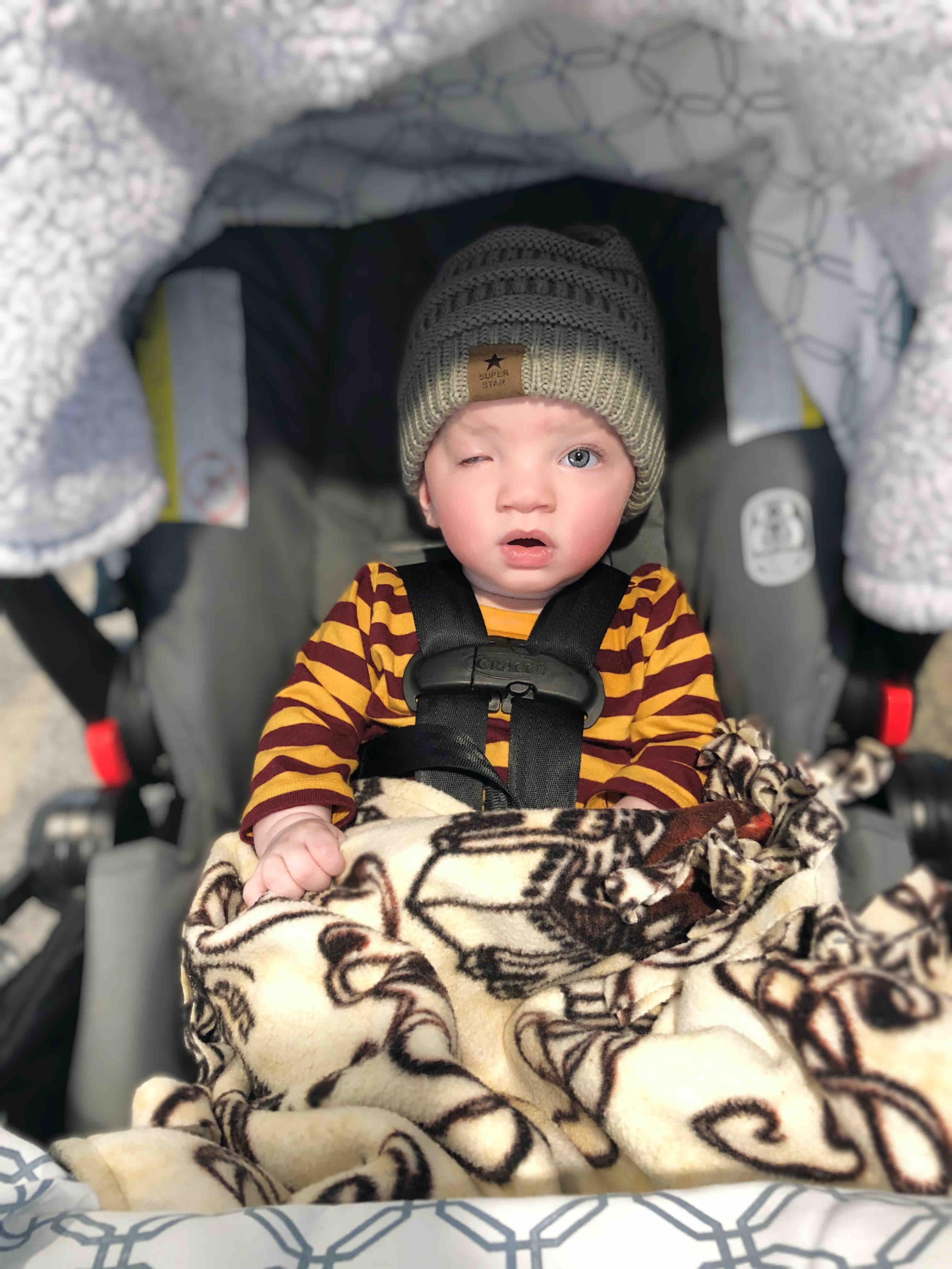 Help Jonathan have beautiful Eyes! photo