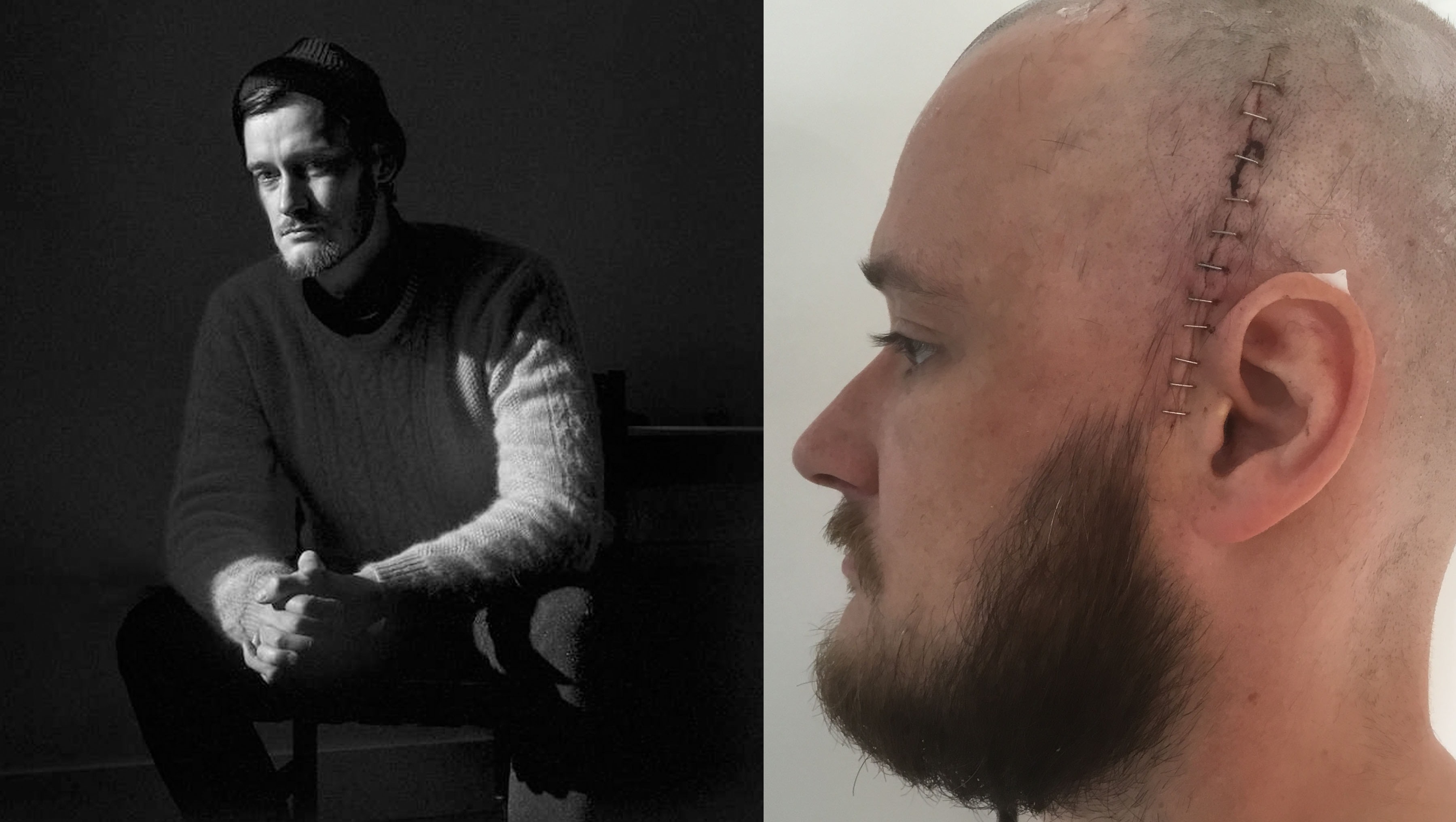 Fundraiser for Derek Dix by Landon Dix : Supporting Derek Through his ...