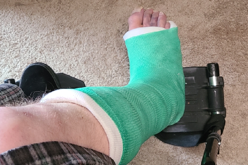 Fundraiser by Daniel Miller Broken ankle in 5 places