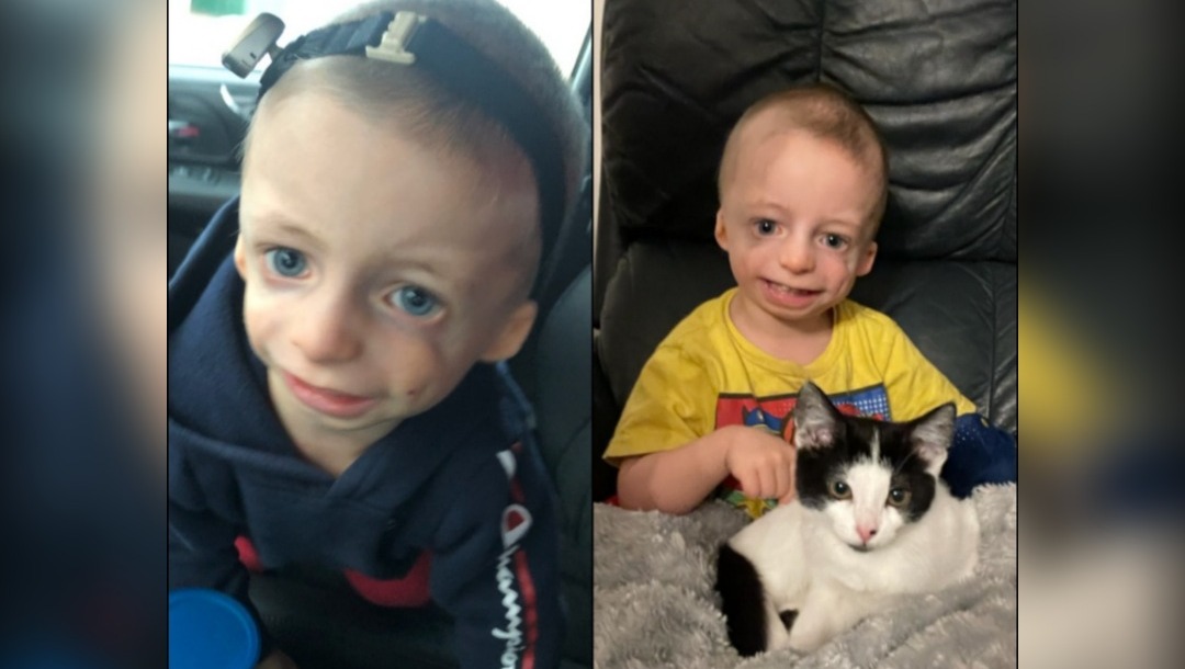 A Hearing Aid for Bodi photo