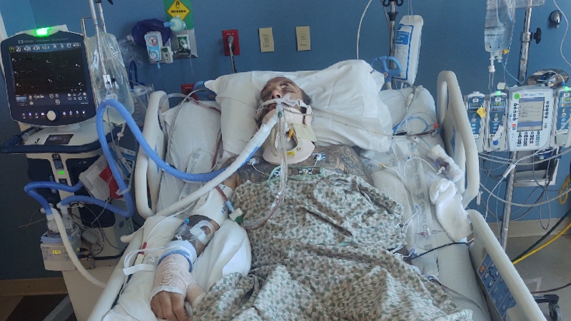 Help Adam walk again. photo