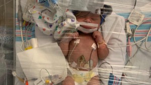 Baby Rajani battles Brain Injury & Cerebral Palsy photo