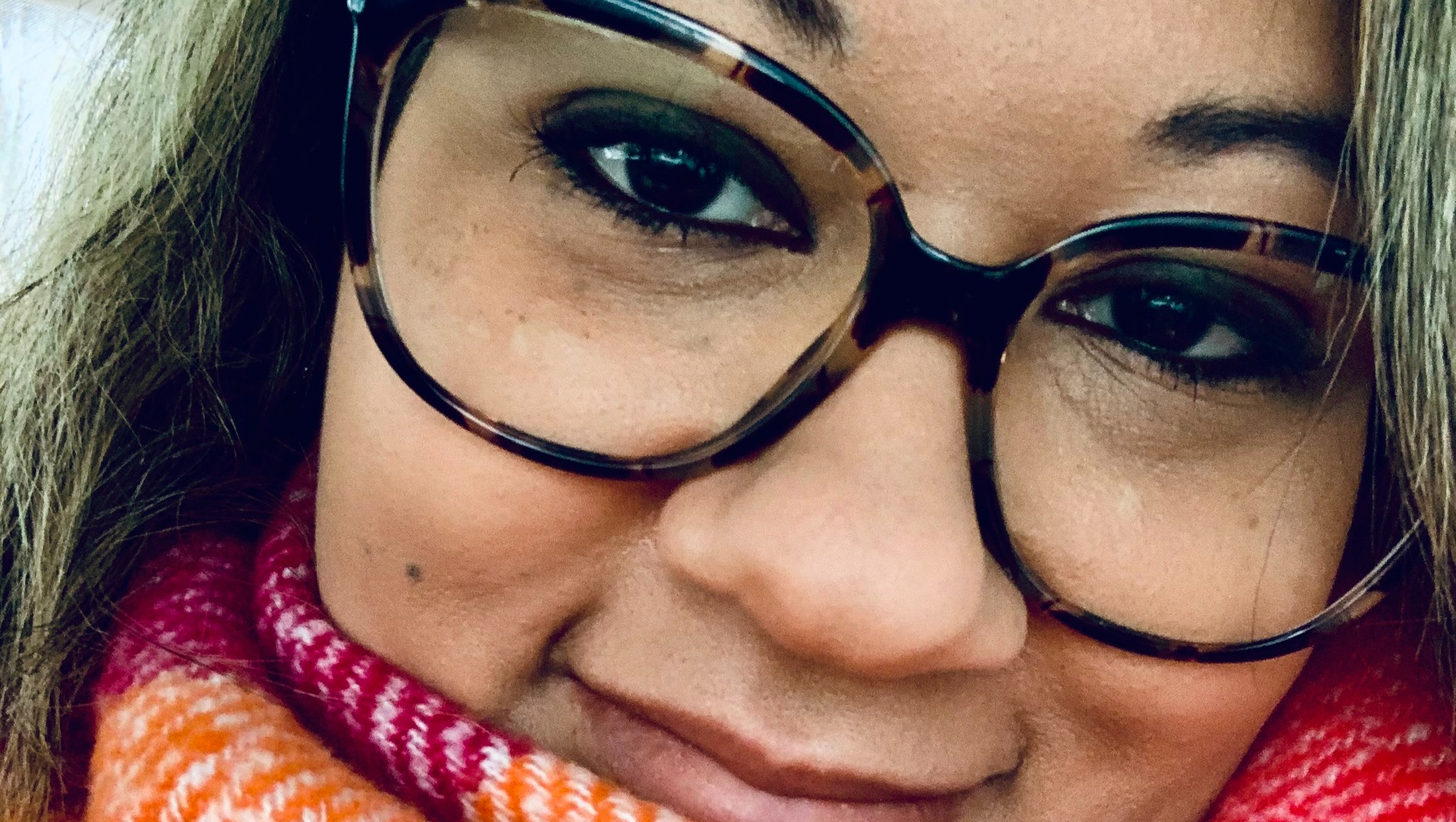 Medically necessary full mouth extraction photo