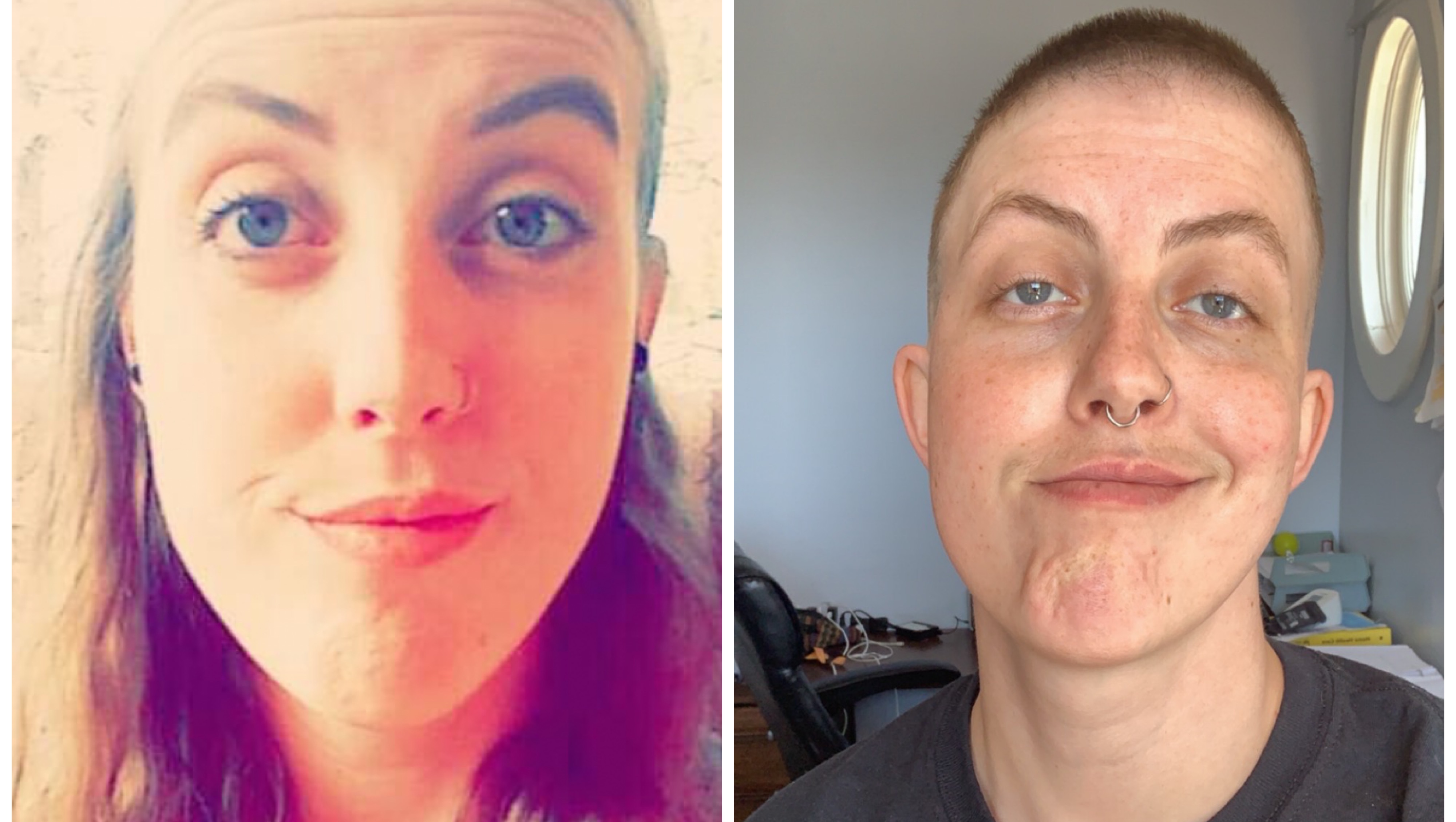 Fundraiser by Hathon top surgery fund