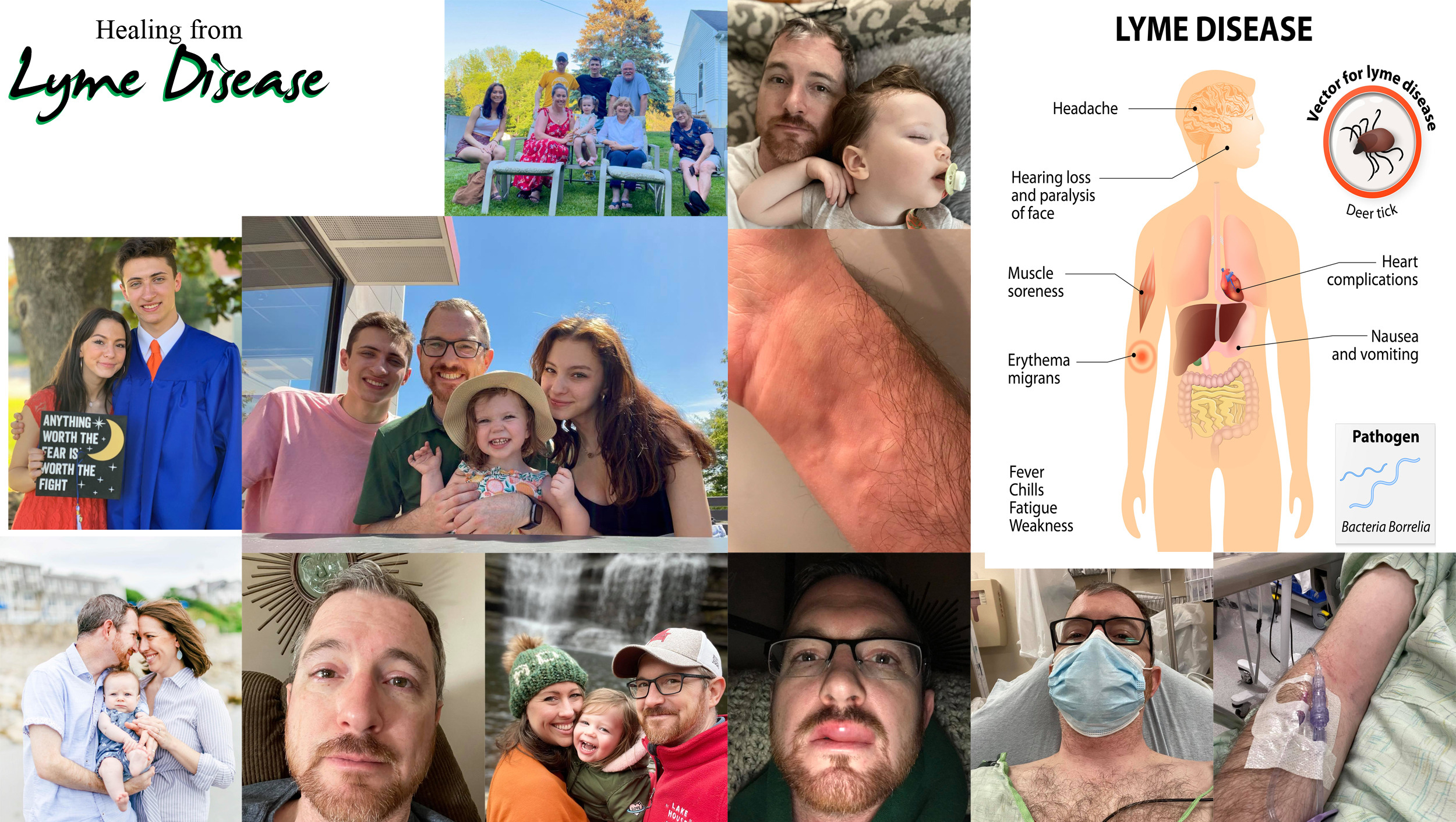 Help Bill Dustin Recover from Lyme Disease photo