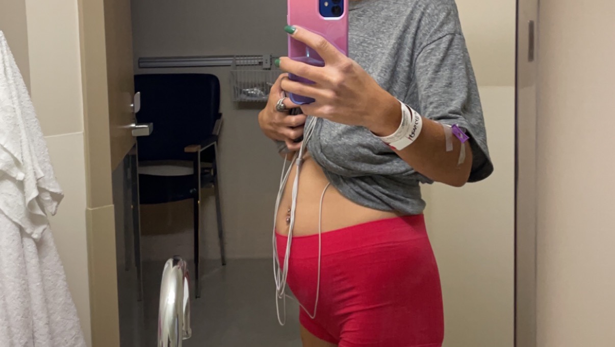 Fundraiser By Renee Kozak Help Renee
