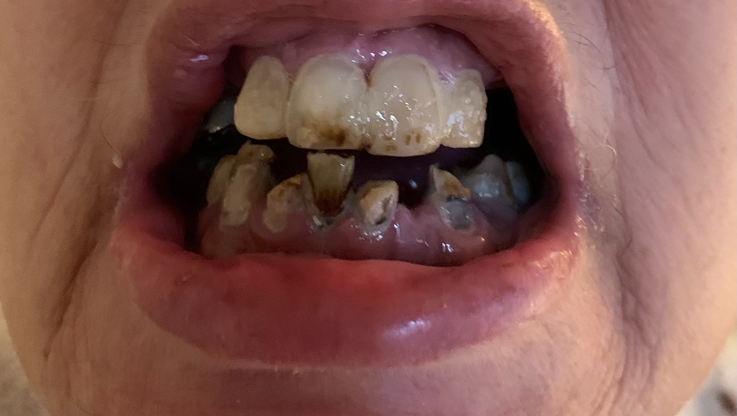 Fundraiser by Debbie Thomas Radiation cancer treatments destroyed my