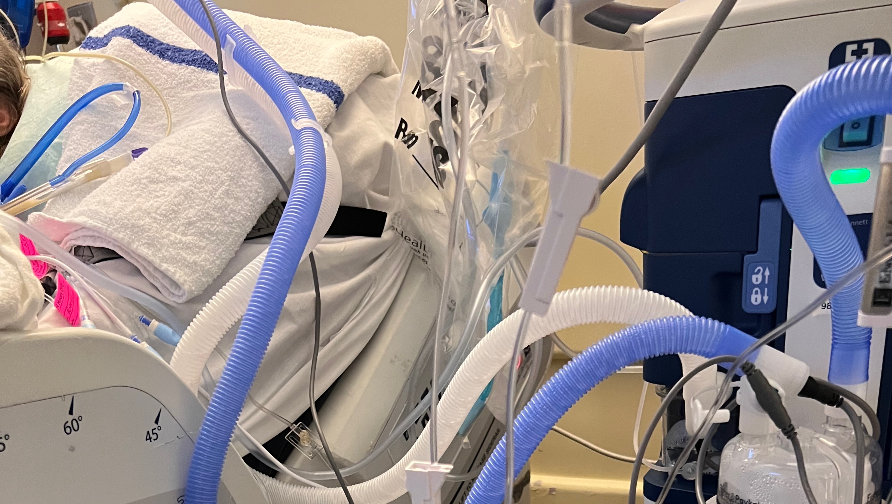 Fundraiser by Eve G Covid pneumonia intubation