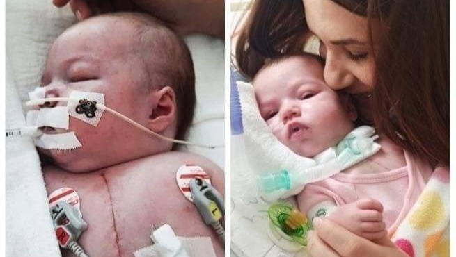 Heart surgery,medical bills, housing and living US photo