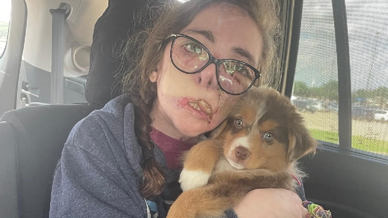 Fundraiser for Jacqueline Durand by Julia Cole : Jacqueline Durand Nearly  Killed in Dog Mauling