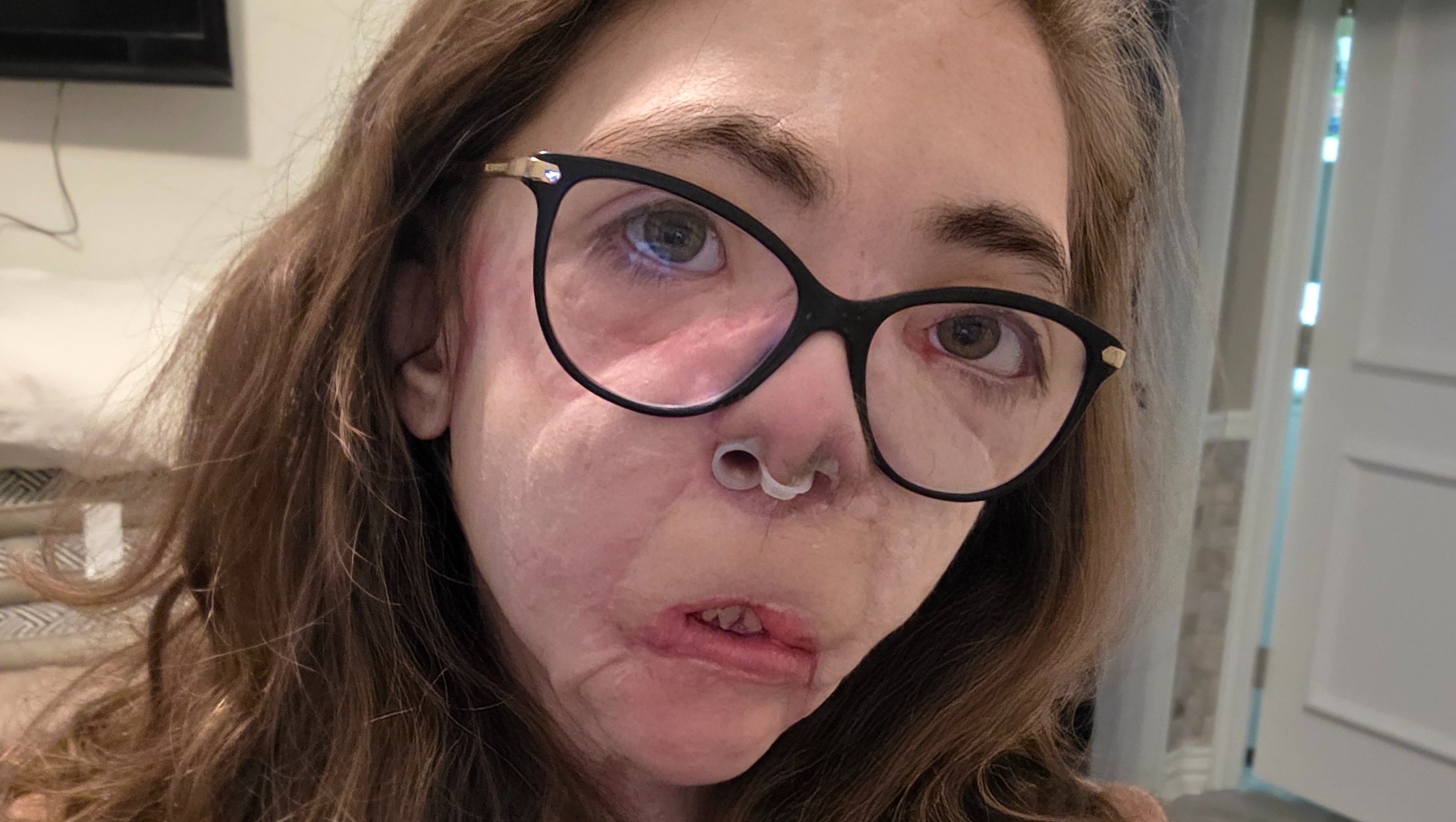 Fundraiser for Jacqueline Durand by Julia Cole : Jacqueline Durand Nearly  Killed in Dog Mauling