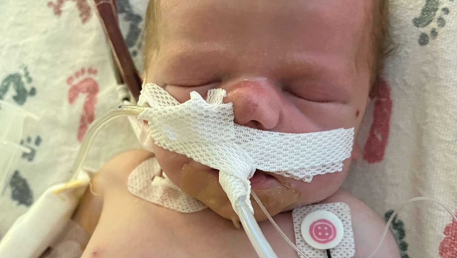 Fundraiser for Hanna Eide by Alex slagle : Paxton Timothy