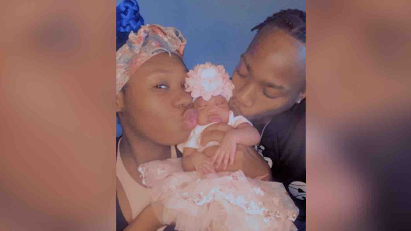 kayaleahs cranial surgery photo