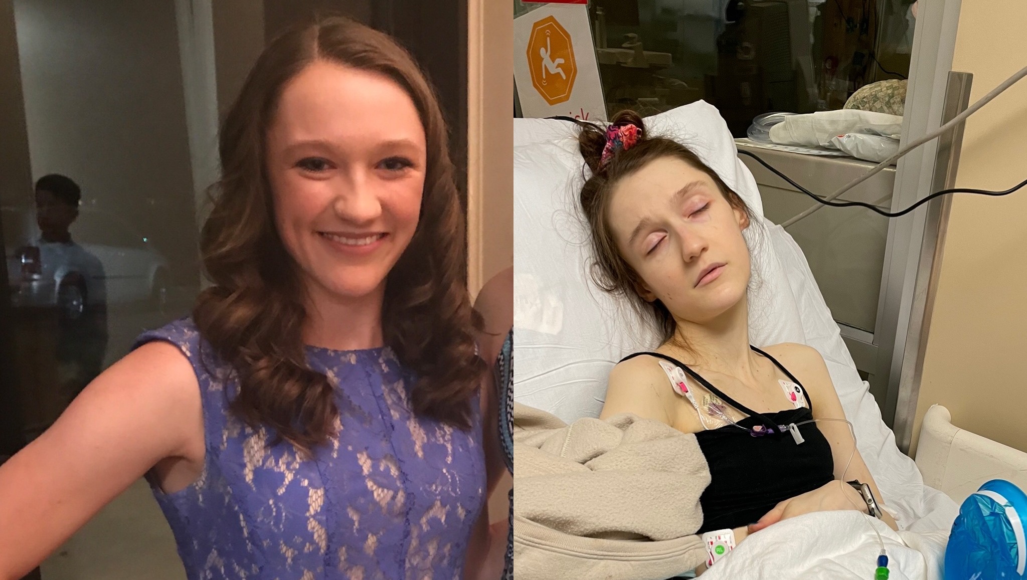 Fundraiser by Katrina Blevins : Isabel's compression surgery in Germany