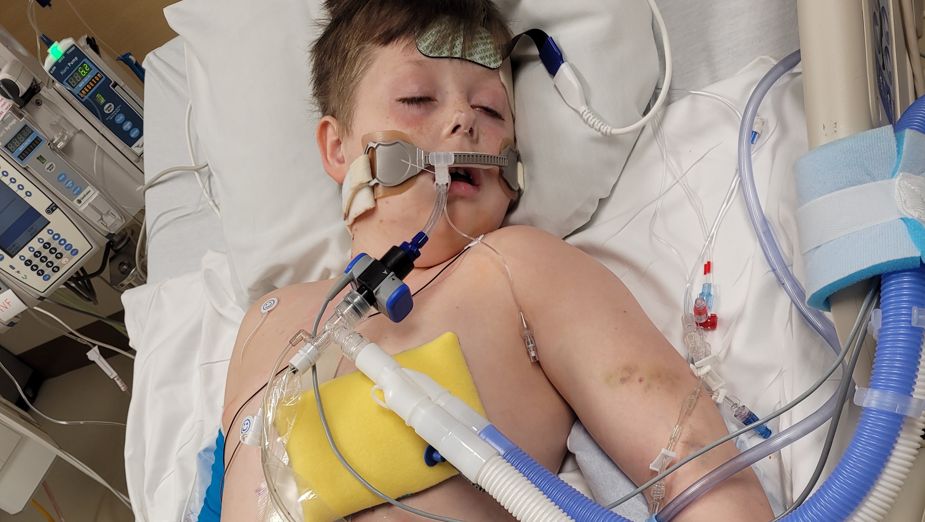 Fundraiser by Ashlie Benson Surgery expenses