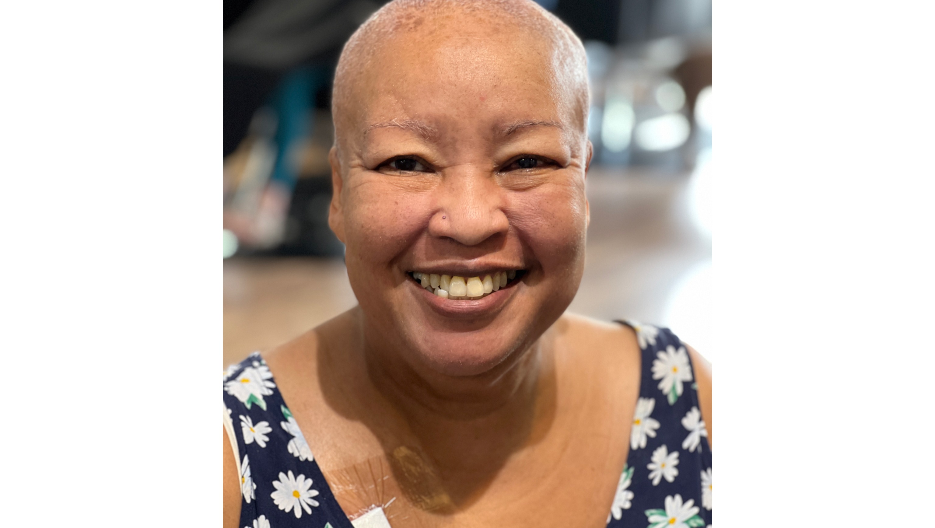 Fundraiser for Sydney Parkin by Sydene Hardware Medical Bills for