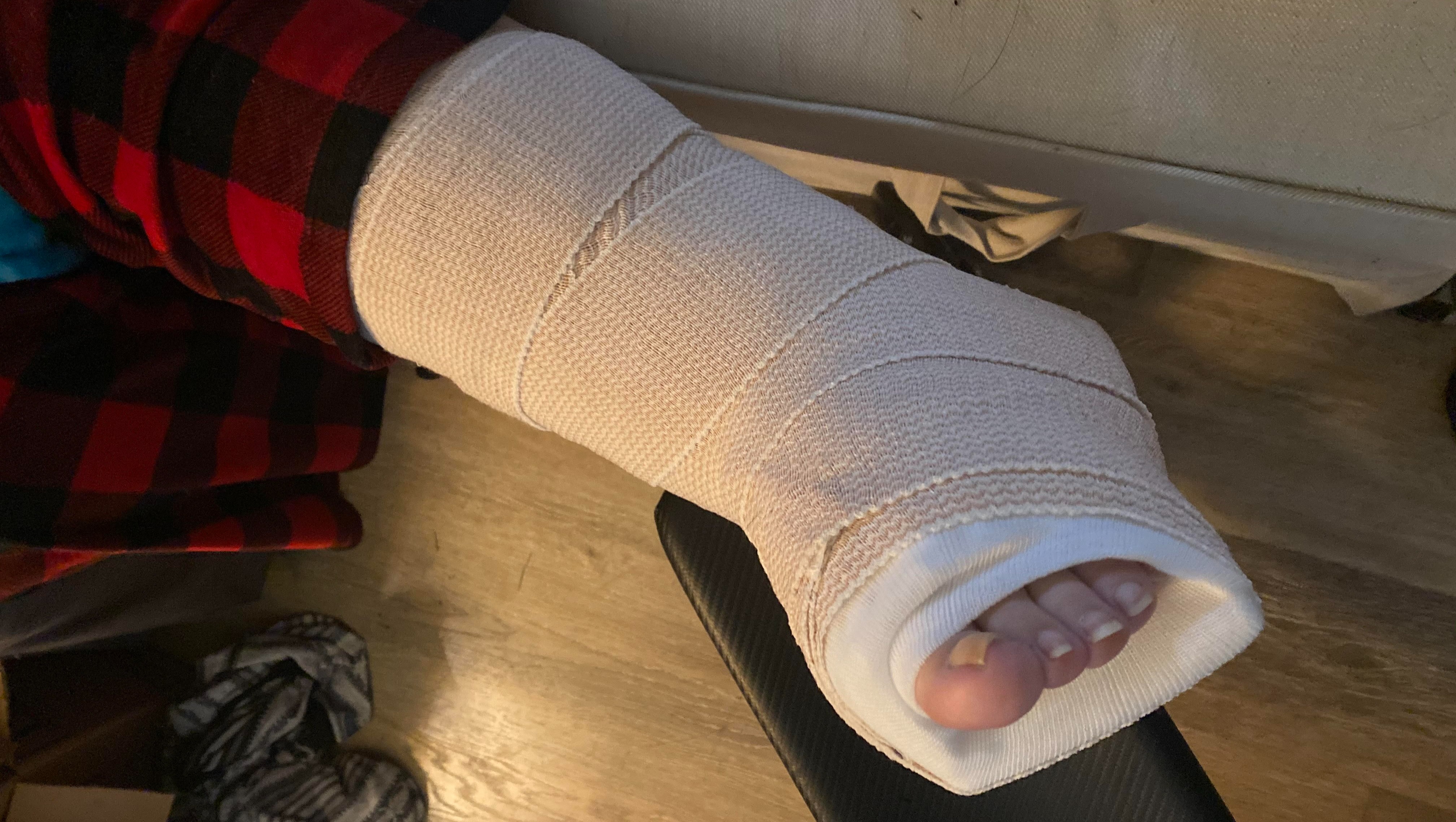My mom broke her ankle, please help! photo