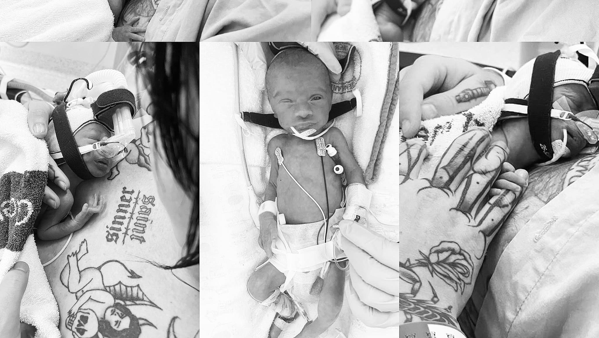 Fundraiser for Gough Greer-Barry by Ruby Greer-Barry : Help Little Gia ...