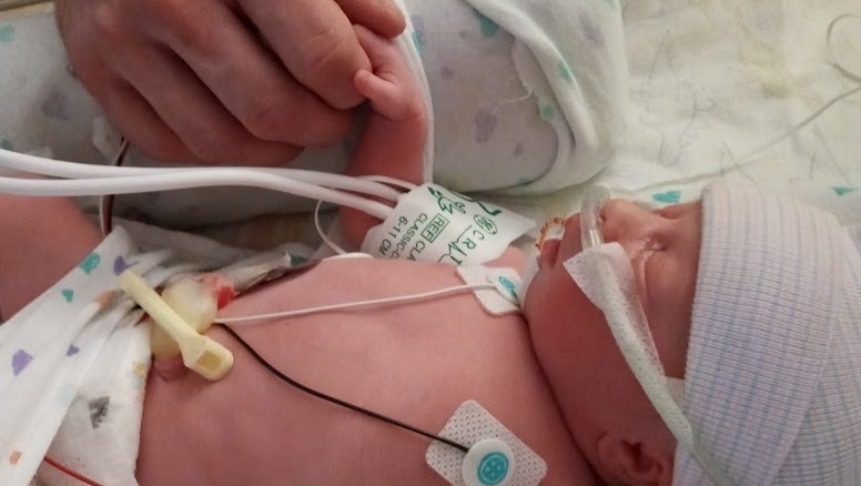 Help bring baby Kylissa and Melissa home safely photo