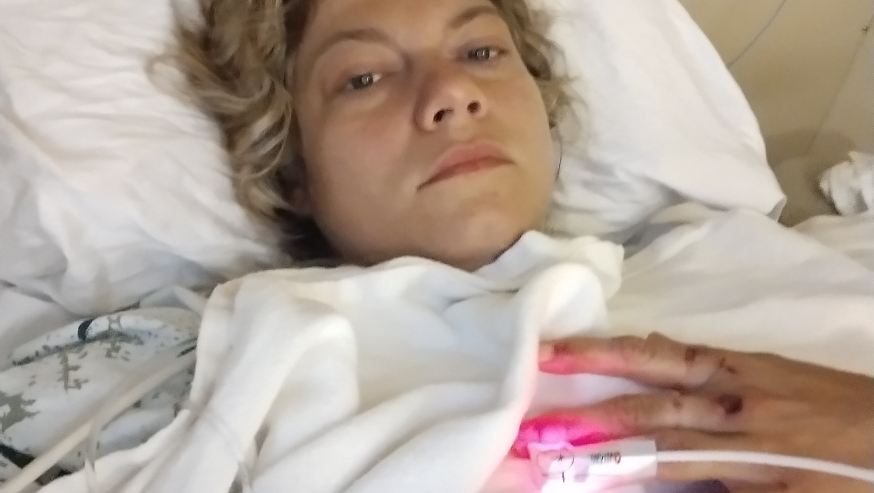 Fundraiser by Jamie Bollmer : Tragedy to Triumph (Helping Jamie Walk Again)