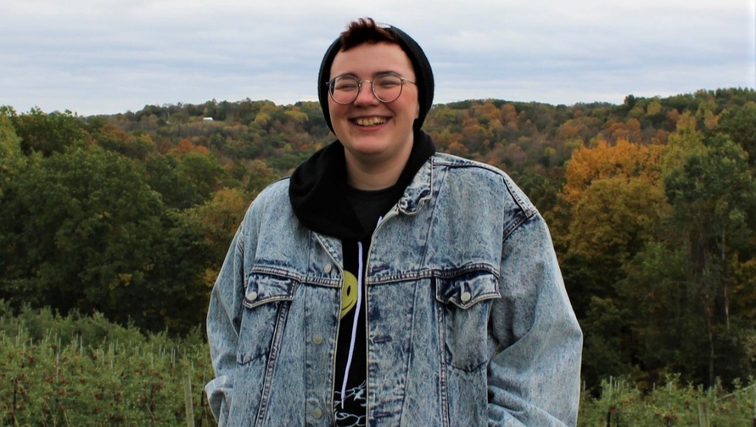 Pay for Tooth's Top Surgery Recovery photo